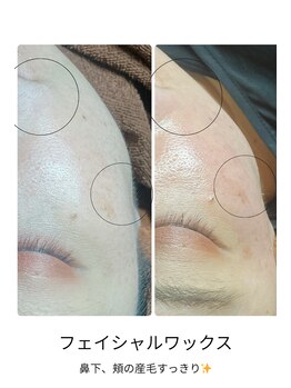 アマンビューティーリゾート/フェイシャルワックス