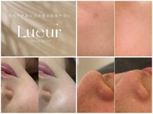 リュール(Lueur)