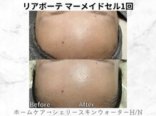 リライン(ReLine)/【マーメイドセル1回】