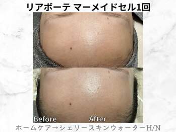 リライン(ReLine)/【マーメイドセル1回】
