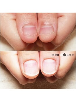 マニブルーム/比較写真