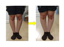 ブループリントピラティス/ピうラティス前後の比較