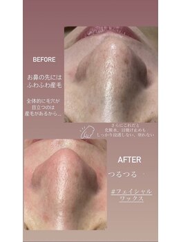 美顔秘密基地 新宮/フェイシャルワックス