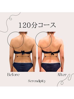 セレンディピティー(Serendipity)/頑固な肩凝りも筋膜ケアで改善へ