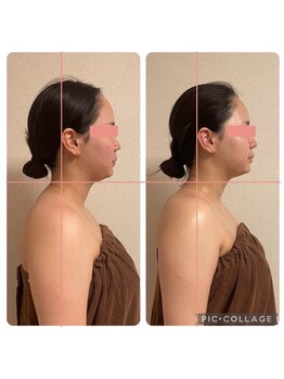 ニアベル(Nia Belle)/パスリルフェイシャル