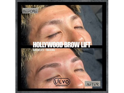 リルボ(LILVO)の写真