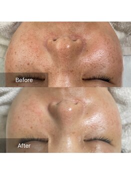 グレイス(Grace)/