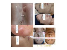 ベルブランシュ(Belle Blanche)の雰囲気（リアボーテでお肌のお悩み改善します★エクラボーテ導入サロン♪）