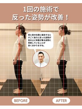 スペックフィジカルコンディショニング(SPECフィジカルコンディショニング)/30代女性/姿勢ビフォーアフター