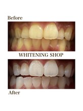 ホワイトニングショップ 四条店/