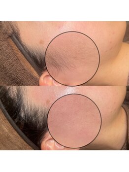 シェリー トウキョウ 西葛西店(Cherie Tokyo)/肌に低刺激なワックス脱毛◎