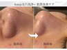 【毛穴トラブル解消】毛穴ケア×肌質改善フェイシャル★60分6000円