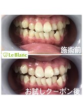 ルブラン 奈良店(Le Blanc)/フリーパスコース通い放題は