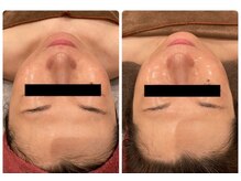 マリスレジーナ 新保店(MarisRegina)/サーマ＆ララピール