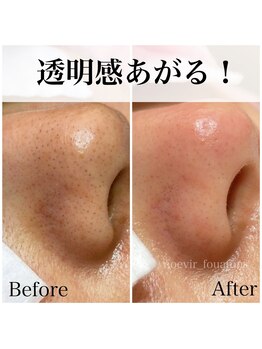 フワットン(Fouatons)/