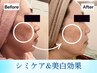 【夏期限定♪】贅沢美白ケア＆小顔リフト+肩デコルテほぐし（90分￥8800→