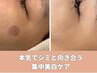 【8月限定】本気でシミと向き合う集中美白ケア　¥22500→¥17500