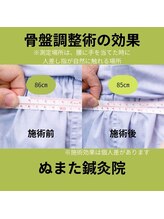 ぬまた鍼灸院/骨盤調整