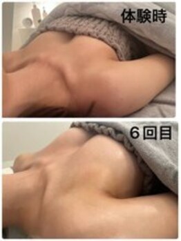 美人バスト 新潟店/ 【バストアップ★育乳】症例