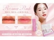 ファッシモ(fascimo)の雰囲気（ローマピンクで黒ずみケアをして肌本来のピンク色へ生まれ変わる）