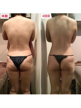 ビタミンスパ 中野店/-2cmダウン★施術回数4回