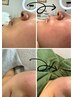 午前中限定顔も眉毛周りもスッキリWax脱毛