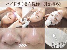 リエイト(Re:eight∞)の雰囲気（最先端のピーリングマシーンでごっそり毛穴洗浄＆古い角質除去）