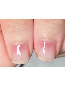 爪の悩みを解消できる（ケア含む）