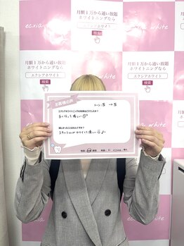 ルアナシンフォニア エクシア 東銀座店(Luana-Sinfonia)/ホワイトニングビフォーアフター