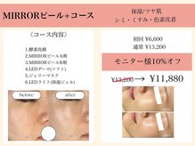 リベルテ(Liberte)