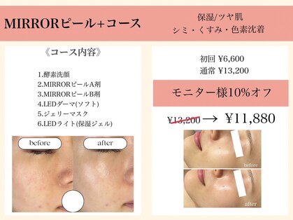 リベルテ(Liberte)の写真