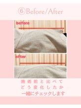 ひがし接骨院/目で見てわかる施術後の変化