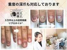 アニュー