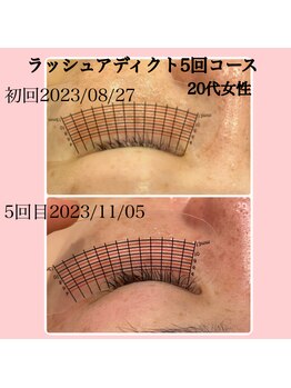 ビューティー アディクト(Beauty addict)/ラッシュアディクト