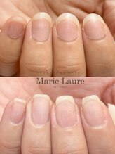 マリーロール 淀屋橋本店(Marie Laure)/自爪育成/深爪矯正/ネイルケア