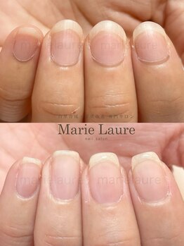 マリーロール 淀屋橋本店(Marie Laure)/自爪育成/深爪矯正/ネイルケア