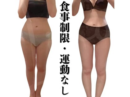 ヨサパーク リノ 大分駅前店(YOSA PARK Lino.)の写真