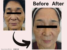 ミネルバエンダモロジー/エンダモロジー/フェイシャル