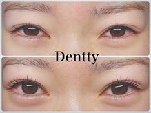 ネイルサロン デンティ(Dentty)/まつげパーマ