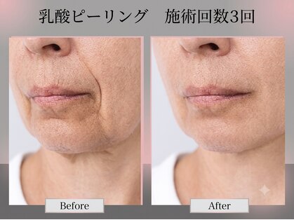 フィオーレ(Fiore)の写真