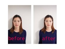 えもと鍼灸整体院の雰囲気（肩こり・首のコリを取るとお顔もすっきりの美顔効果。）