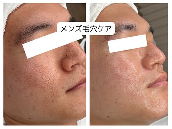 アロマ(AROMA)/メンズ凹凸ケア、