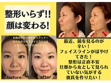 ケイ 福岡天神店(Kei)