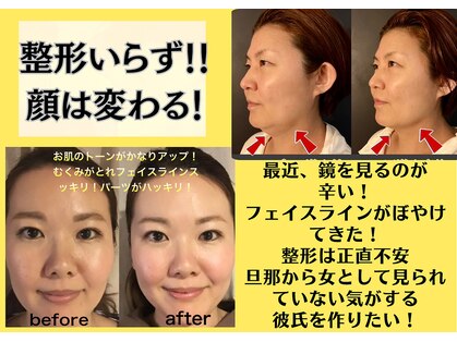 ケイ 福岡天神店(Kei)の写真