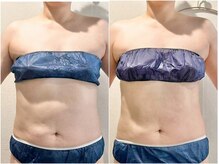 サロン ド ブラン アオヤマ(Salon de BLANC AOYAMA)/上半身ボディ60分