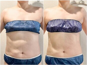 サロン ド ブラン アオヤマ(Salon de BLANC AOYAMA)/上半身ボディ60分