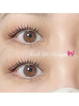 ユーロ(EURO)/立ち上げ緩カール