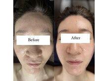 ジョーヌ(JAUNE)/悩み肌が多幸感溢れるお肌へ