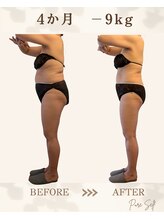 ピュアセルフ 新浦安(Pure Self)/背中の段差も消える！