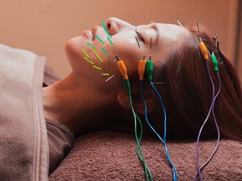 菫鍼灸院/頭皮鍼付き美容鍼